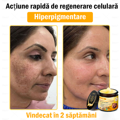 🎁🐝 Crema regeneratoare Sinvie® cu venin de albine 🔥– 50 ml🎁